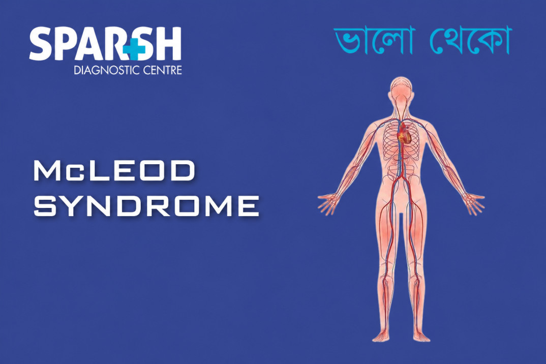 McLeod Syndrome