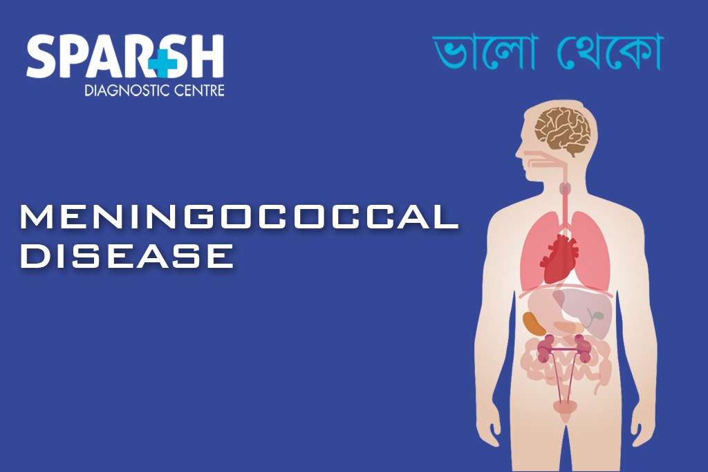 Meningococcal Disease