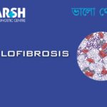 Myelofibrosis