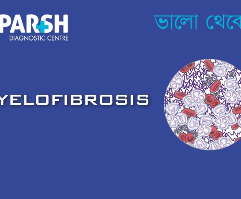 Myelofibrosis