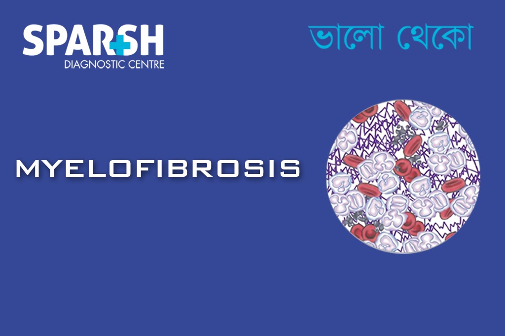 Myelofibrosis