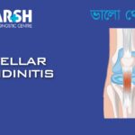 Patellar Tendinitis
