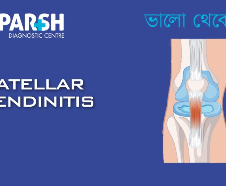 Patellar Tendinitis