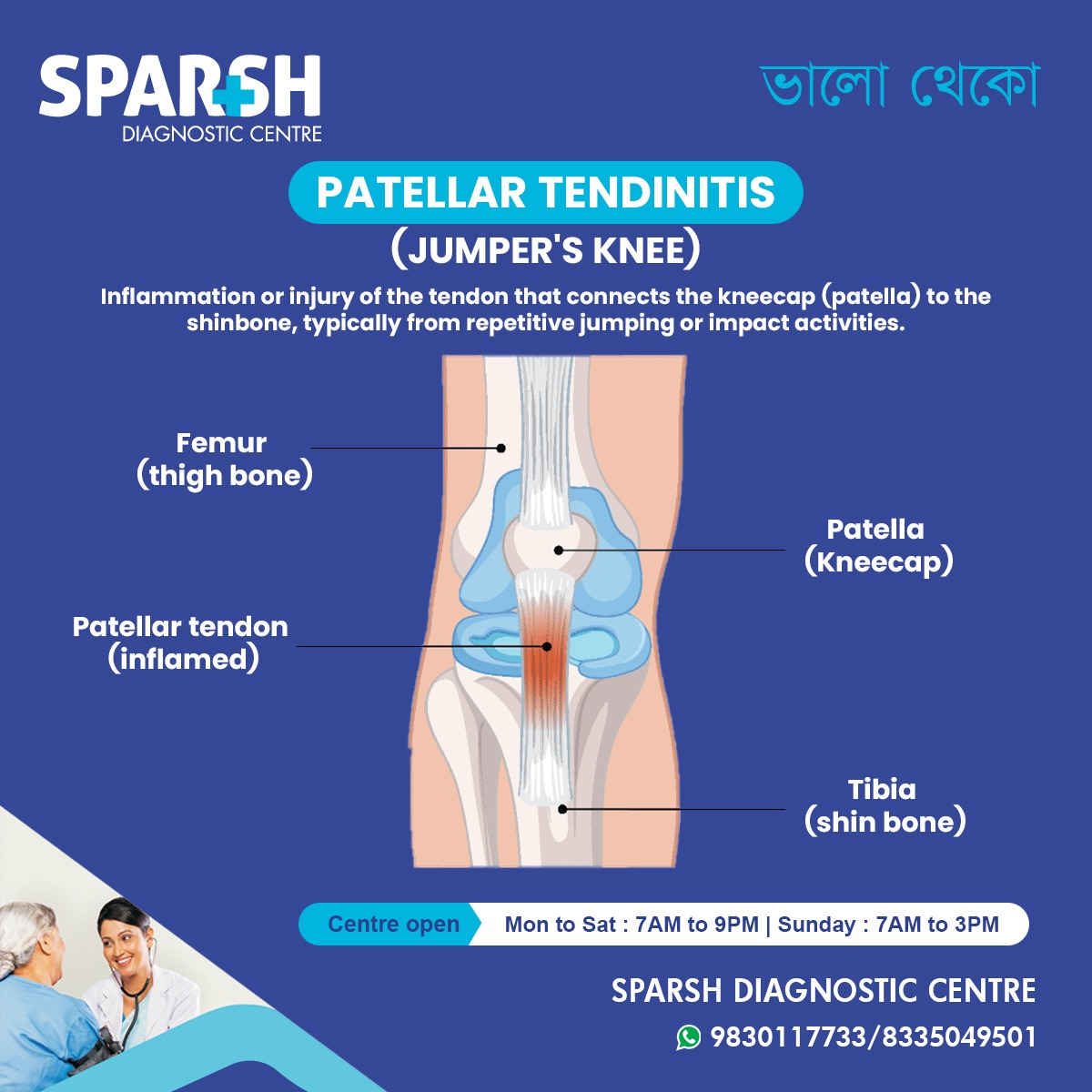 Patellar Tendinitis Jumpers Knee