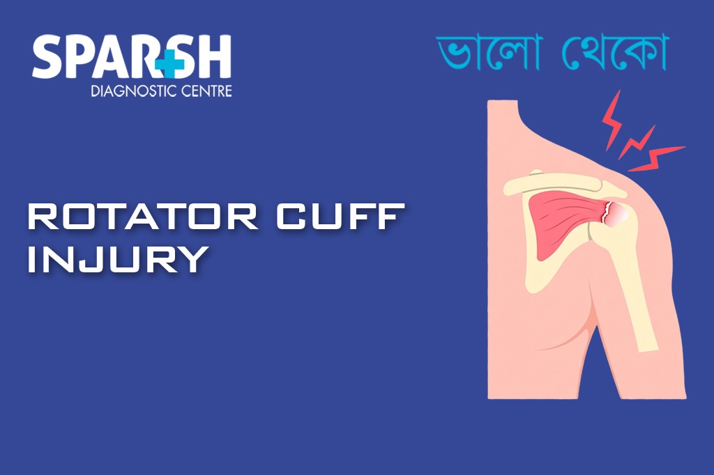 Rotator Cuff Injury CP