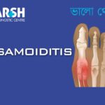 Sesamoiditis CP