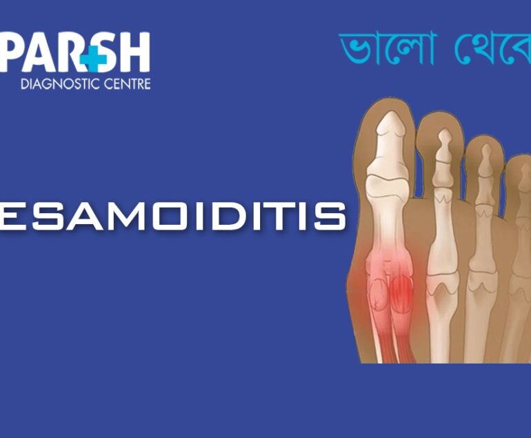 Sesamoiditis CP