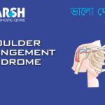 Shoulder Impingement Syndrome CP