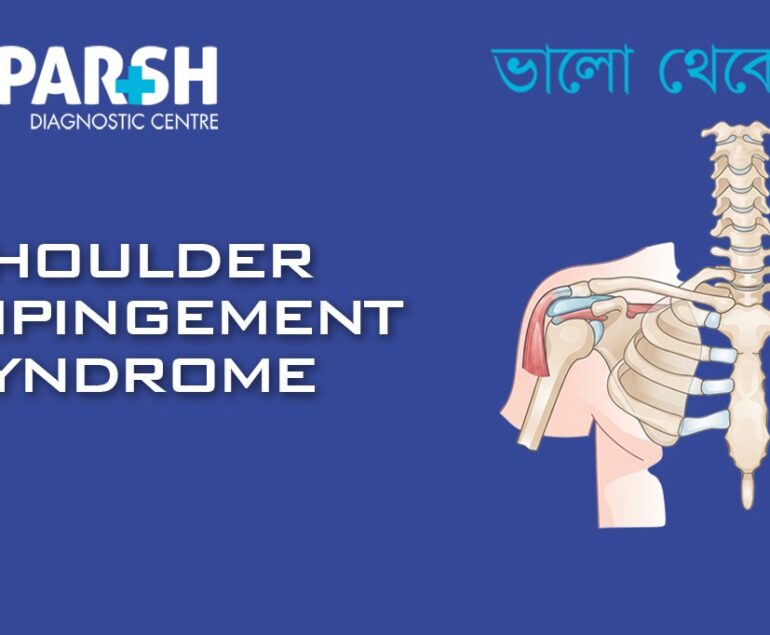 Shoulder Impingement Syndrome CP