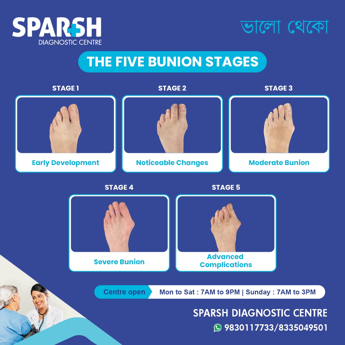 Stages Of Bunion