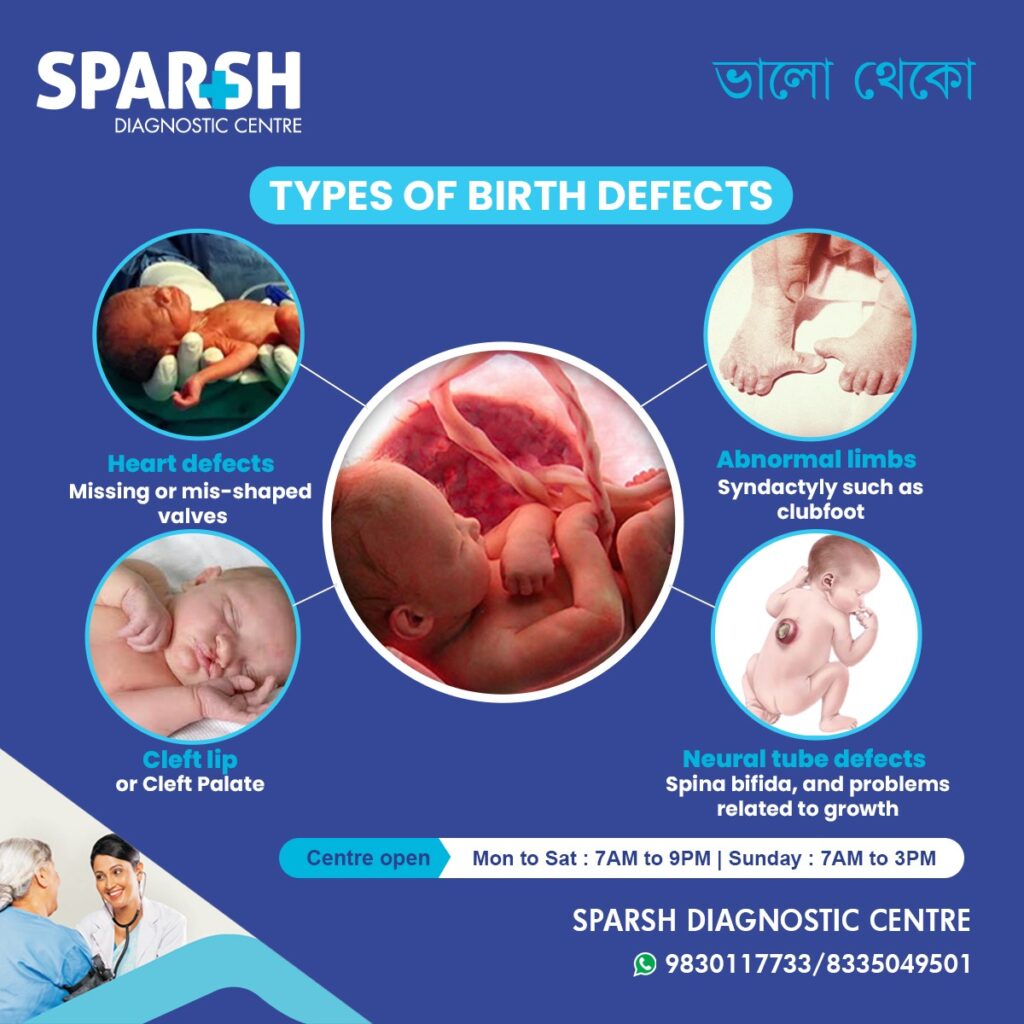 Birth Defects: Types, Causes, Symptoms, Diagnosis, and Prevention ...