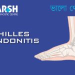 Achilles Tendonitis
