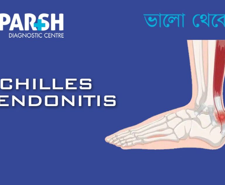 Achilles Tendonitis