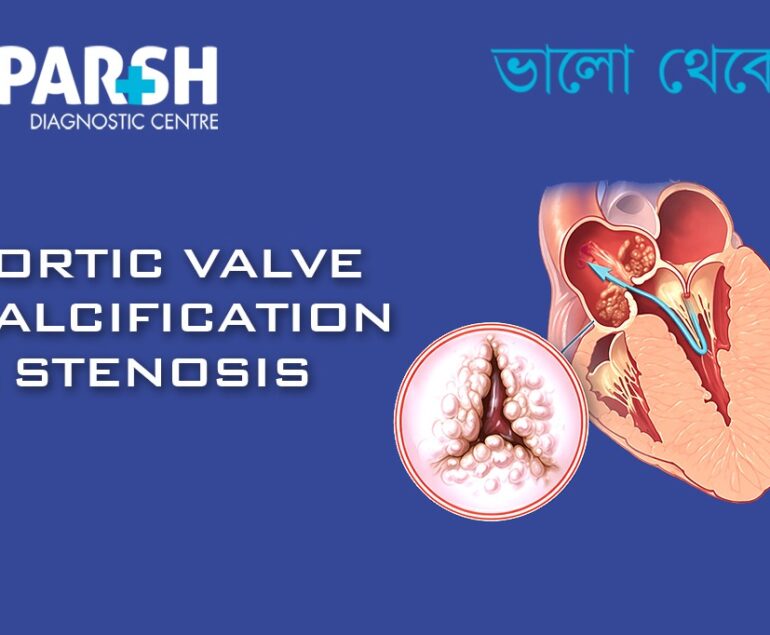 Aortic Valve Calcification Stenosis