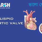 Bicuspid Aortic Valve