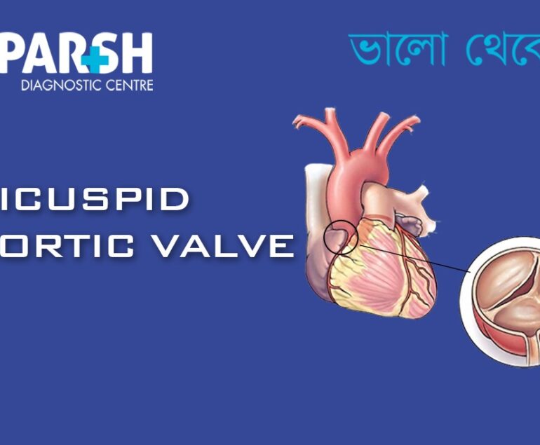 Bicuspid Aortic Valve
