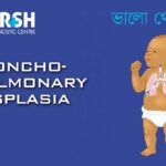 Bronchopulmonary Dysplasia