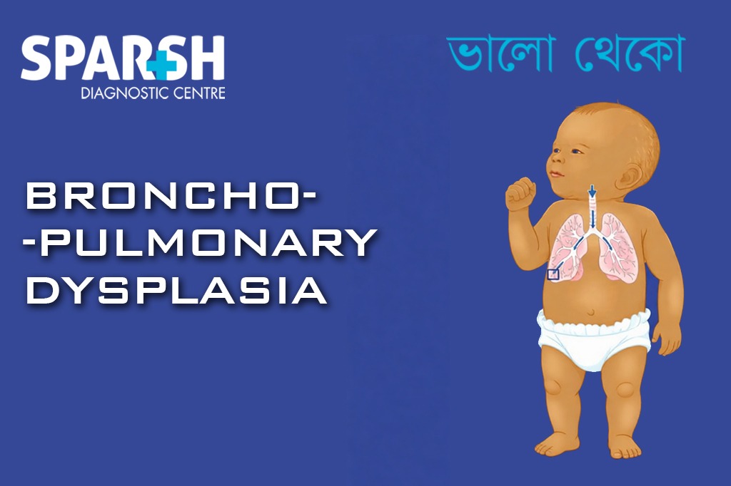 Bronchopulmonary Dysplasia