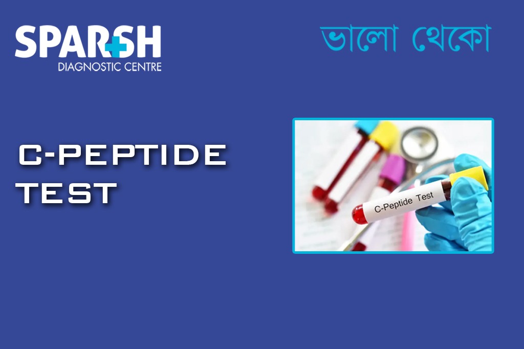 C Peptide Test CP