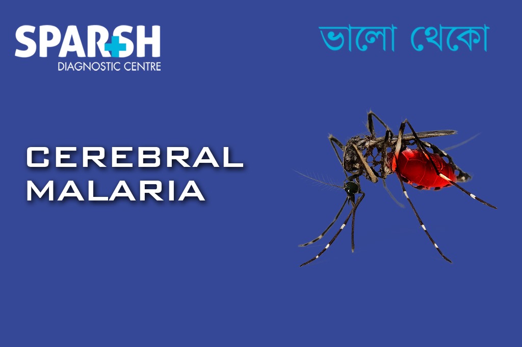 Cerebral Malaria
