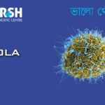 Ebola