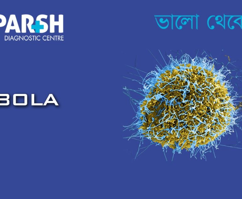 Ebola