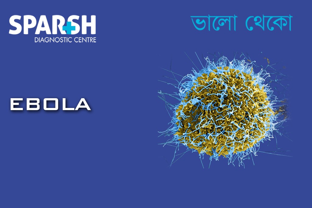 Ebola
