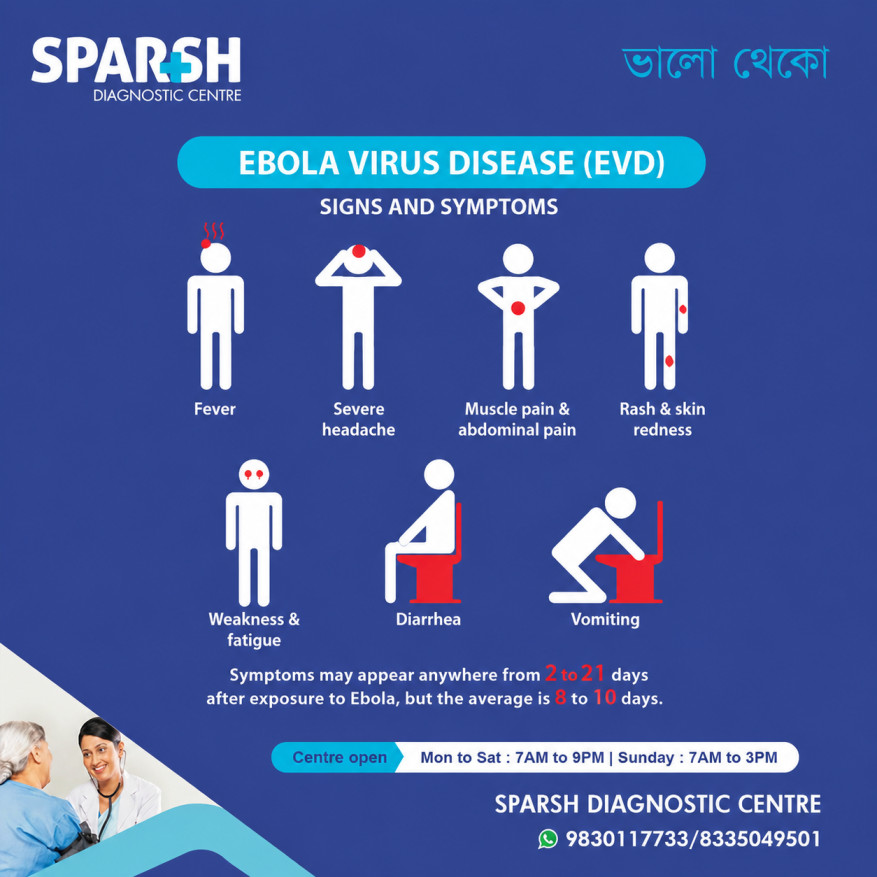 Ebola