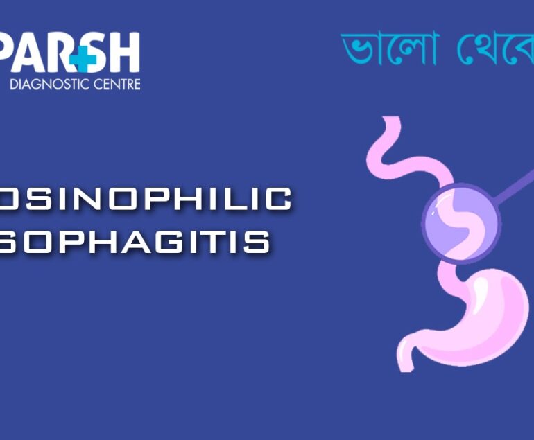 Eosinophilic Esophagitis