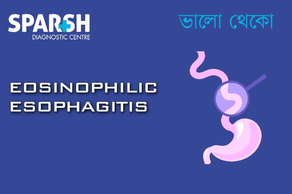 Eosinophilic Esophagitis