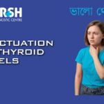 Fluctuations Of Thyroid Levels