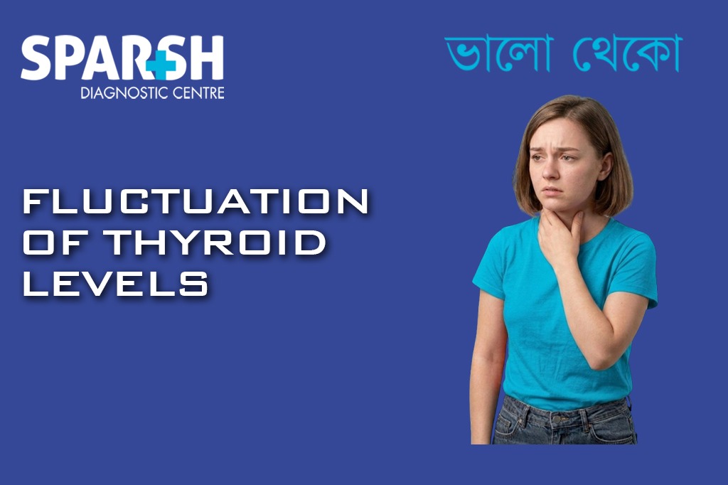 Fluctuations Of Thyroid Levels