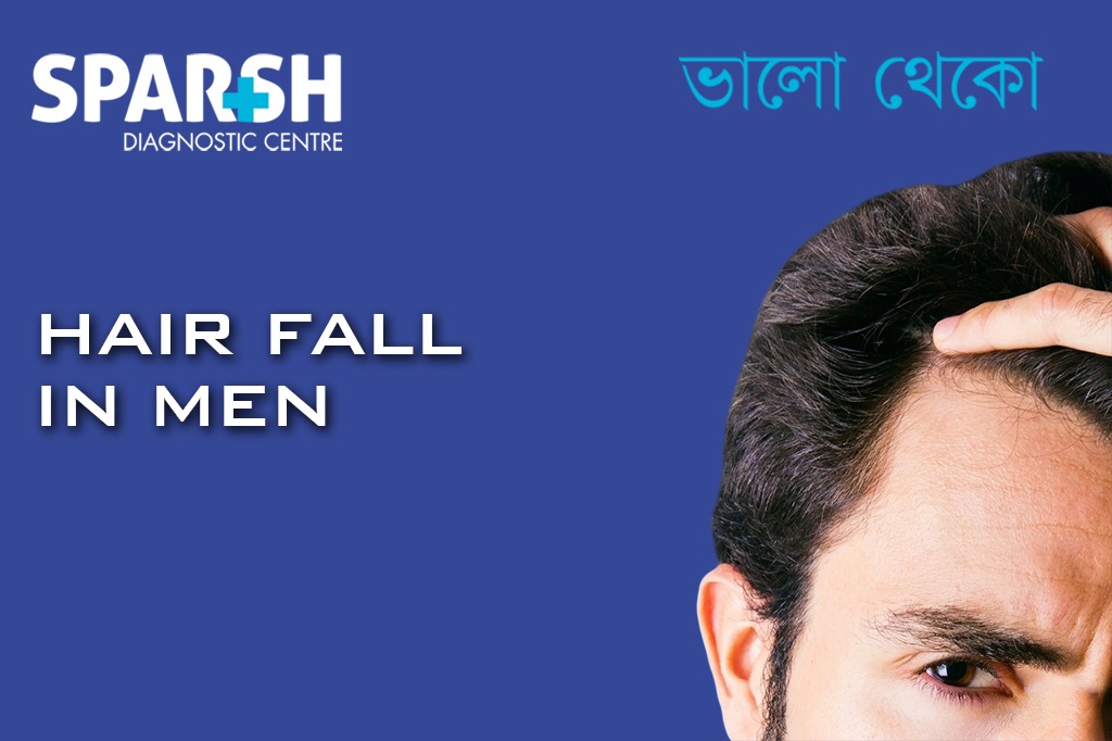 Hairfall In Men