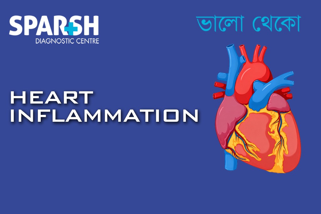 Heart Inflammation