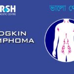 Hodgkin Lymphoma