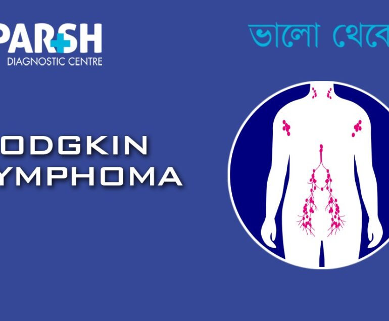 Hodgkin Lymphoma