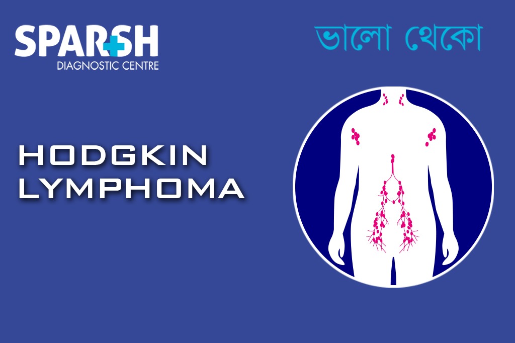Hodgkin Lymphoma