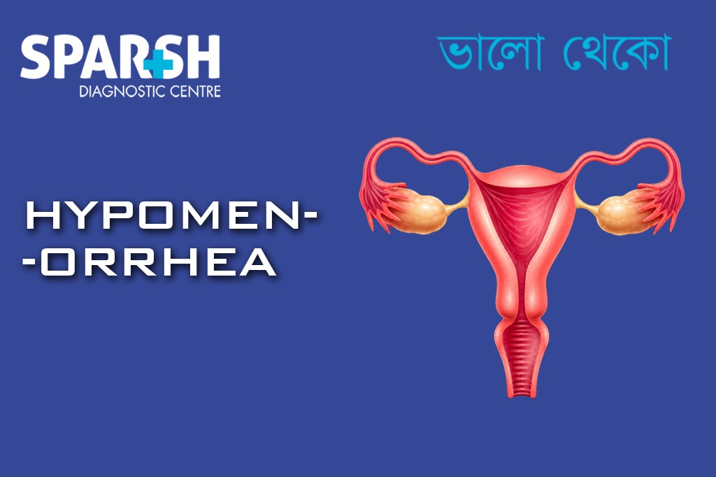 Hypomenorrhea