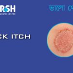 Jock Itch CP