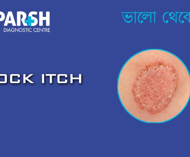 Jock Itch CP