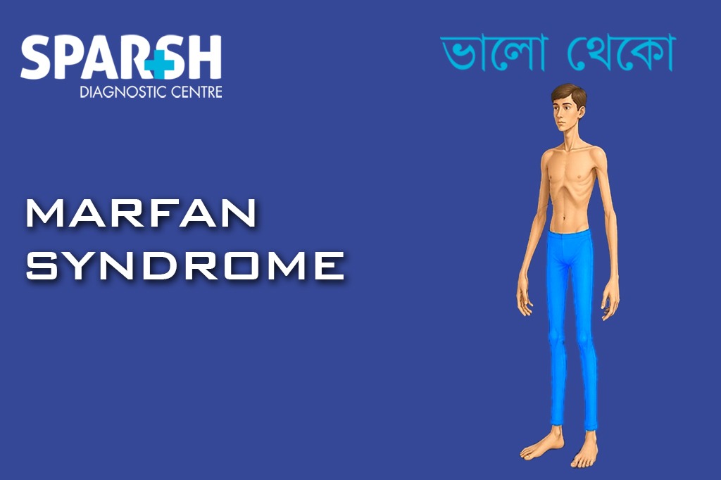 Marfan Syndrome CP