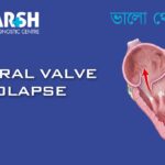 Mitral Valve Prolapse