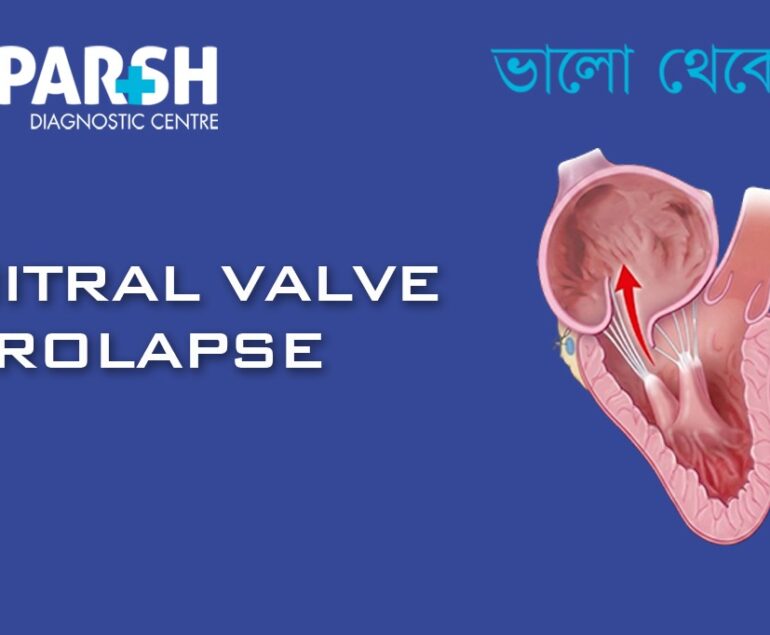 Mitral Valve Prolapse