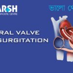 Mitral Valve Regurgitation