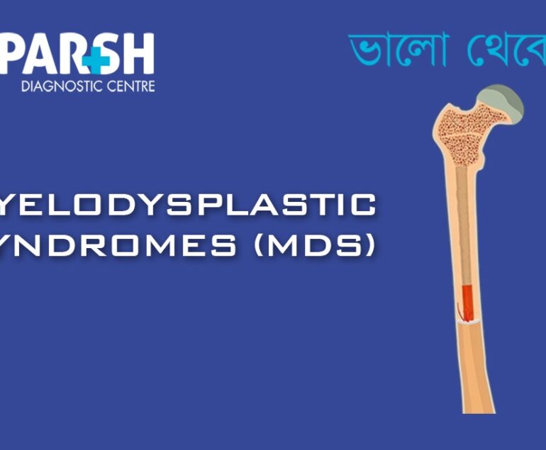 Myelodysplastic Syndromes