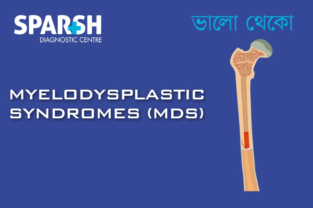 Myelodysplastic Syndromes