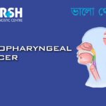 Nasopharyngeal Cancer