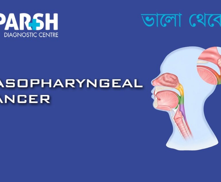 Nasopharyngeal Cancer