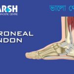 Peroneal Tendon