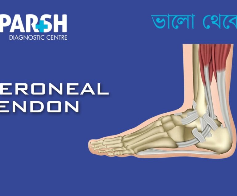 Peroneal Tendon